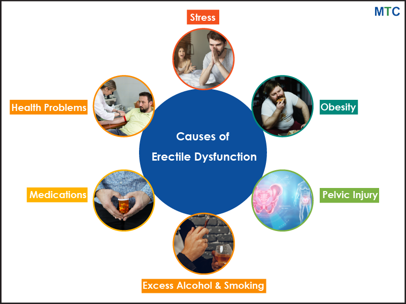 Causes of Erectile Dysfunction