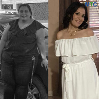Weight Loss Surgery in Piedras Negras | Before & After
