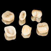 All-ceramic crowns in Los Algodones, Mexico