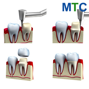 Crown procedure in Costa Rica