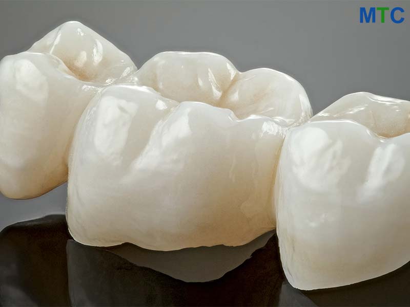 All Ceramic Crowns