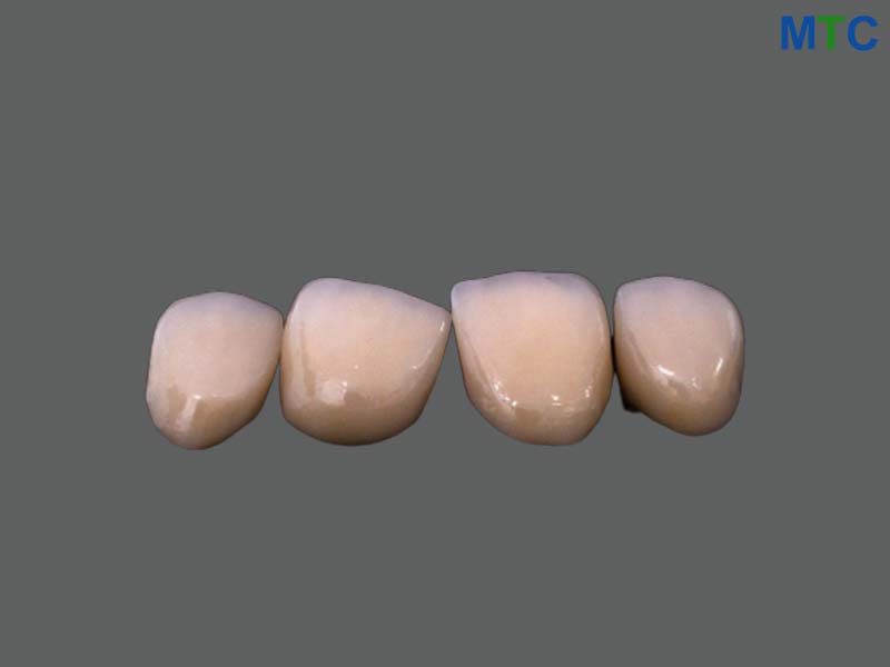 Zirconia Crowns