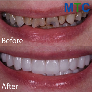 Magic of Cosmetic Dentistry