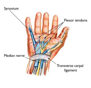 Carpal Tunnel Release Illustration