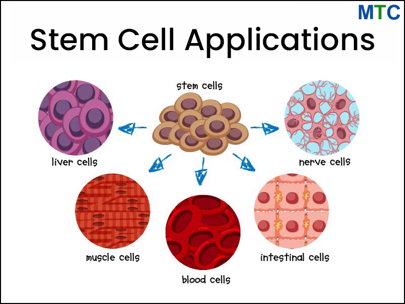 Different Types Stem Cells Can Develop Into