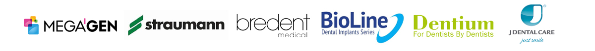 Dental implant brands in Chisinau, Moldova