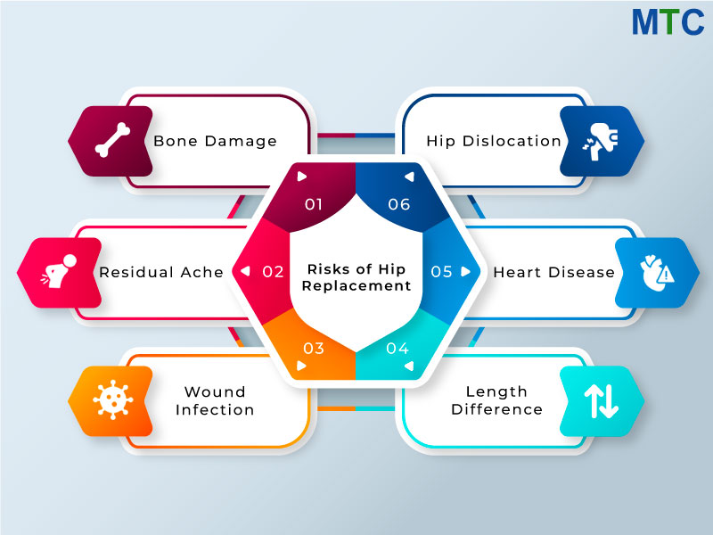 Risks of Hip Replacement Surgery