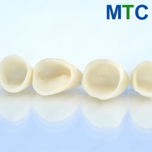 Porcelain Crowns 