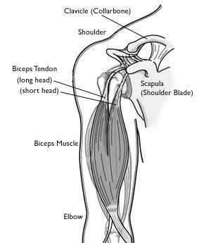 Biceps Tendon Surgery in Mexico