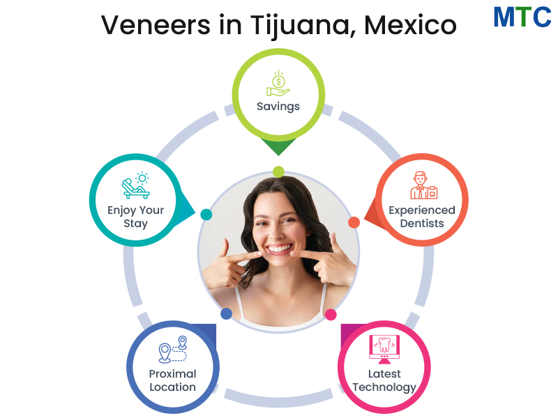 Veneers in Tijuana, Mexico